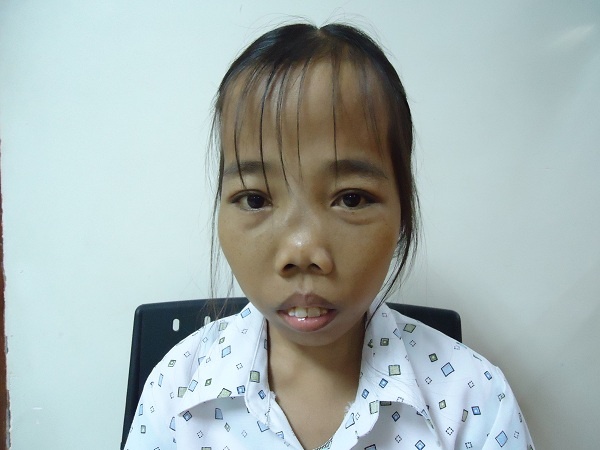 Giao su, bac si huyet hoc: 'Tay khong bat giac di truyen' hinh anh