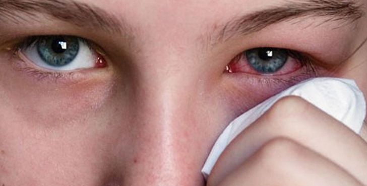 Dung de mu mat vi kinh ap trong hinh anh