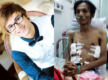 Thái Lan Viên trước khi bị bệnh và sau ca phẫu thuật. Ảnh: NLĐ