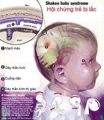 Can than hoi chung rung lac o tre hinh anh