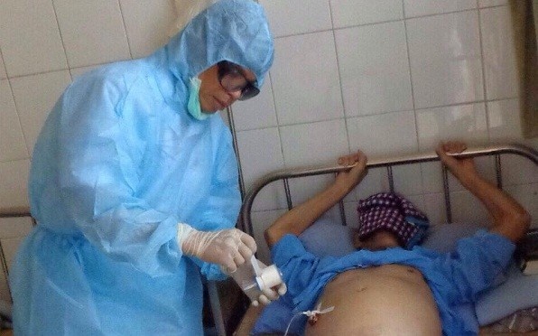 Can lam gi khi bi dam kim vao nguoi? hinh anh