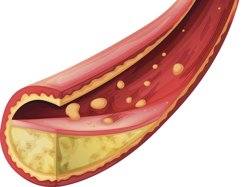 Nhung dieu chua biet ve cholesterol hinh anh