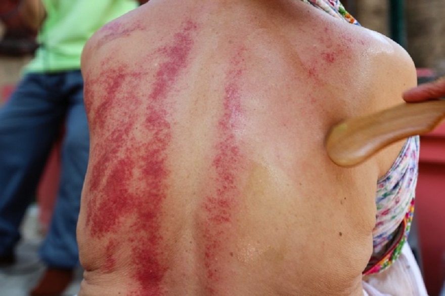 Ai nen cao gio, ai nen tranh? hinh anh