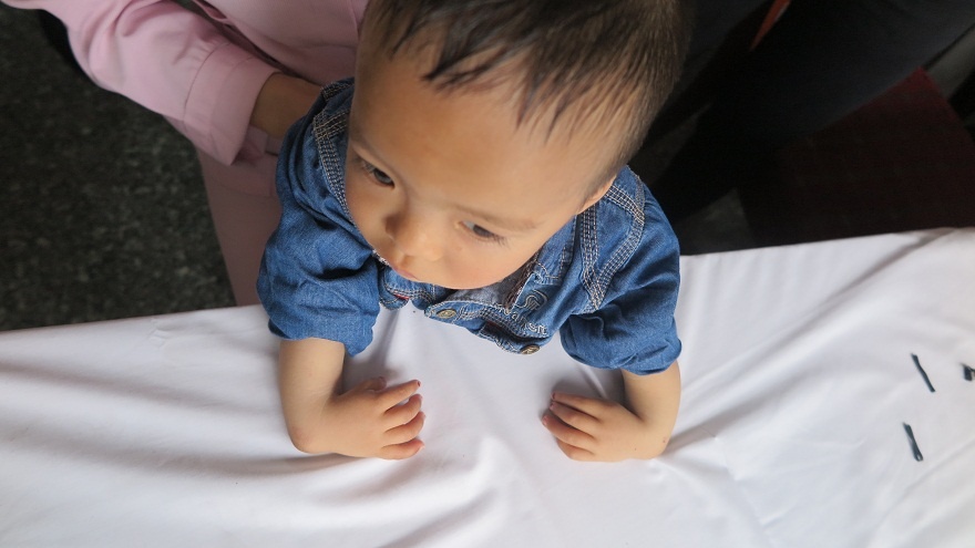 Phau thuat di tat mien phi cho 60 tre em ngheo hinh anh