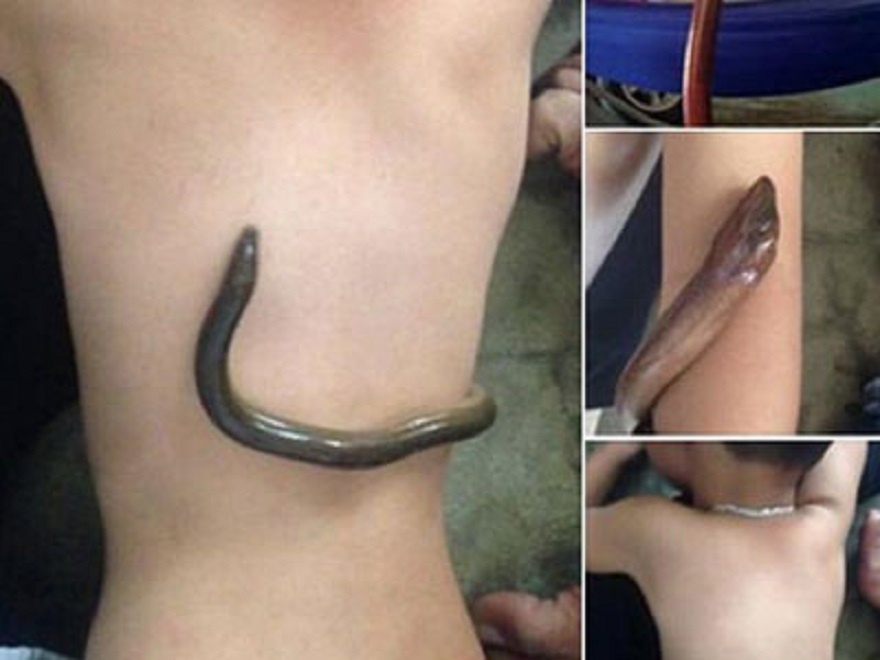 Dung luon song ha sot cho con nguy hiem ra sao? hinh anh