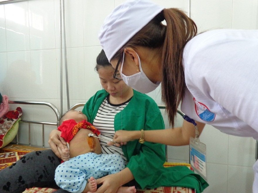 Cat bo khoi u 1,5 kg trong o bung be hon 3 thang tuoi hinh anh