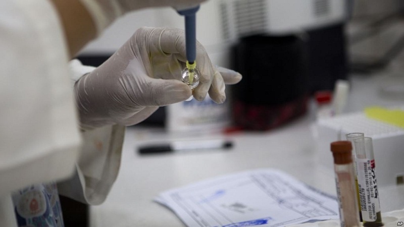 Nghi nhiem virus Zika tai Viet Nam can xet nghiem o dau? hinh anh