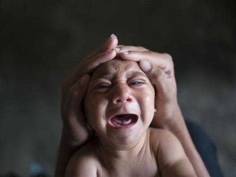 xét nghiệm virus zika ở đâu ảnh 1 xet nghiem virus zika o dau anh 1