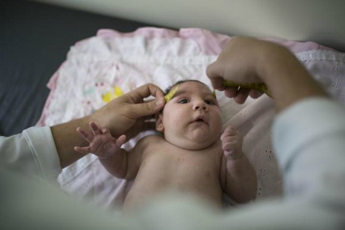 Virus Zika: Bo Y te ra khuyen cao voi phu nu mang thai hinh anh