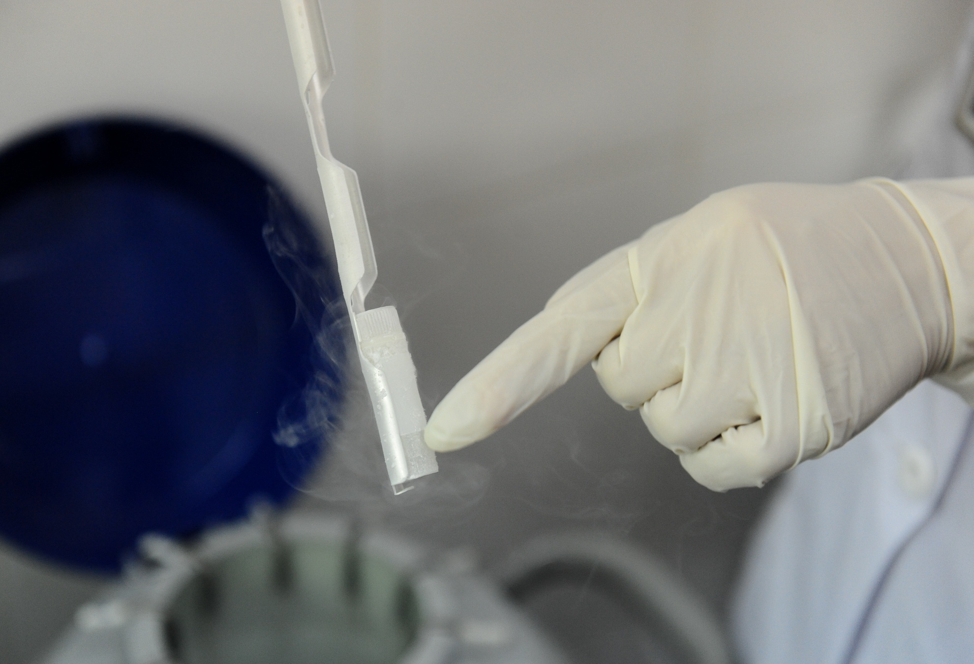 quy trình trữ đông tinh trùng ảnh 10 quy trinh tru dong tinh trung anh 10