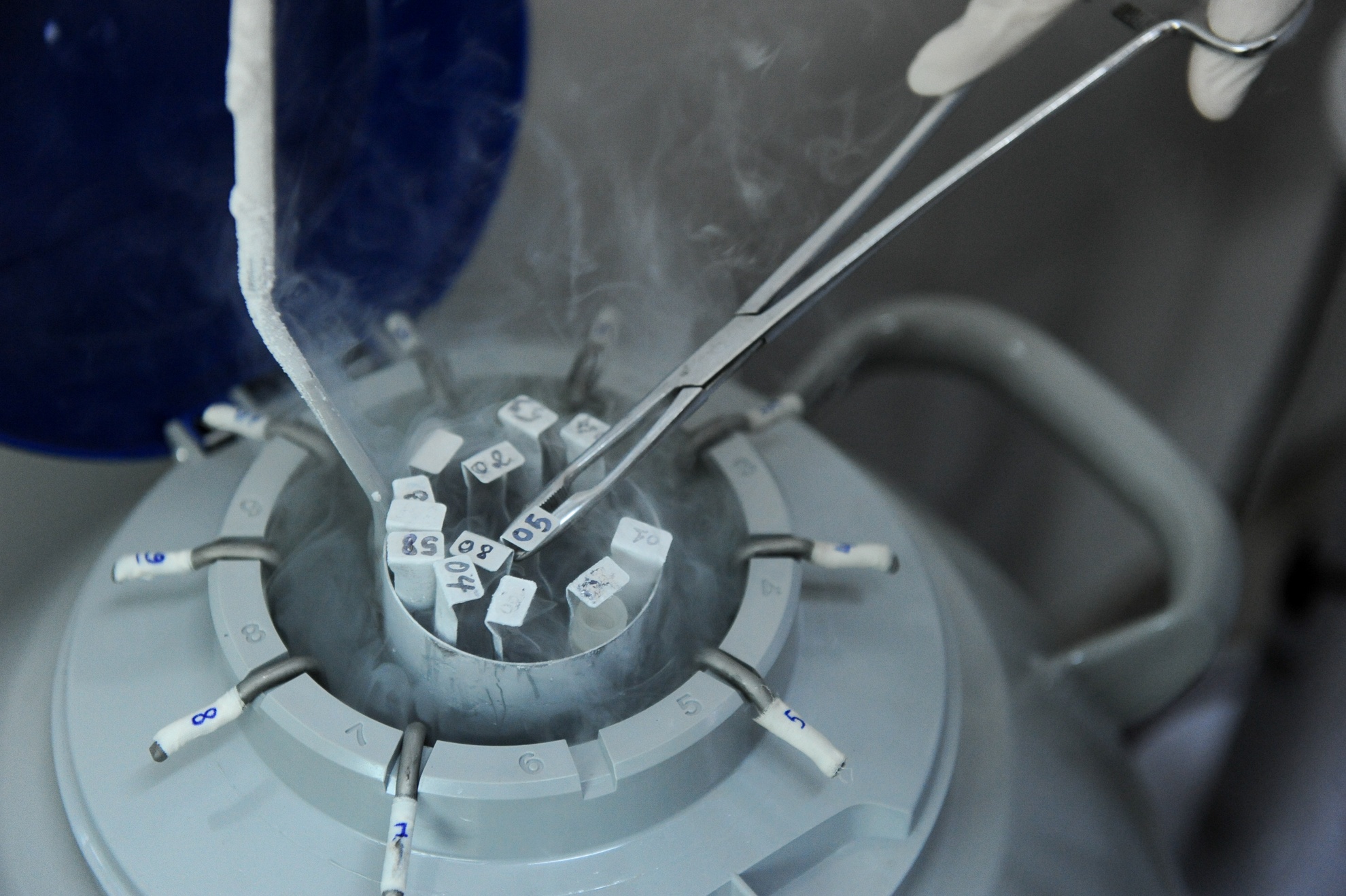 quy trình trữ đông tinh trùng ảnh 8 quy trinh tru dong tinh trung anh 8