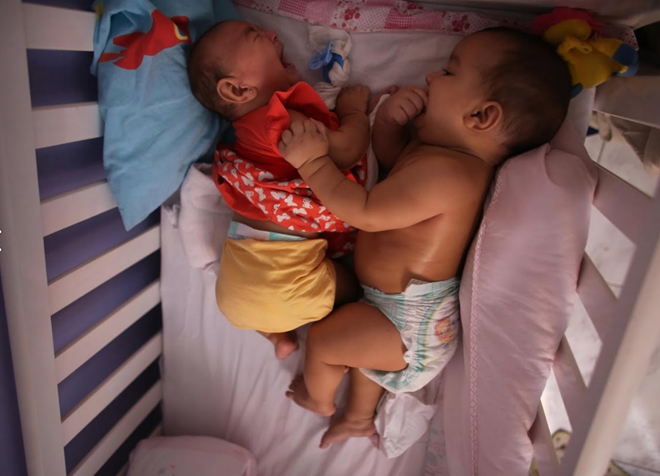 Bi an cap sinh doi nhung chi mot em be nhiem virus Zika hinh anh