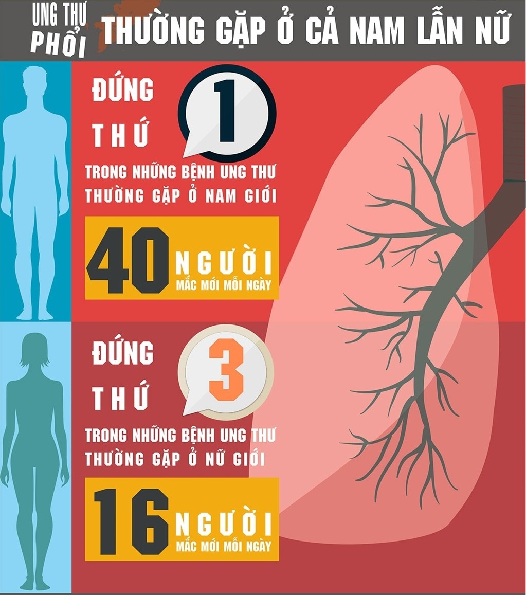 nguy cơ mắc ung thư phổi ảnh 1 nguy co mac ung thu phoi anh 1