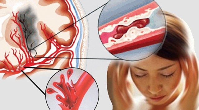 Nguyen nhan hang dau khien ban tro thanh nguoi tan phe hinh anh