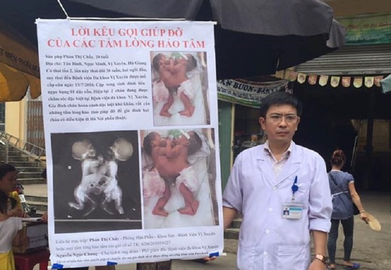 Bac si ra cho keu goi cuu hai be dinh lien: 'Toi da lam can' hinh anh