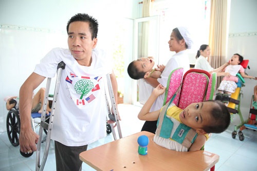 3 lan tach cap song sinh dinh lien anh 1