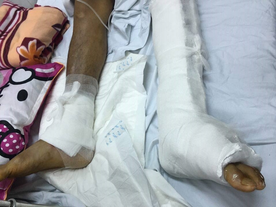 Bo Y te yeu cau xac minh nguyen nhan mo nham chan hinh anh