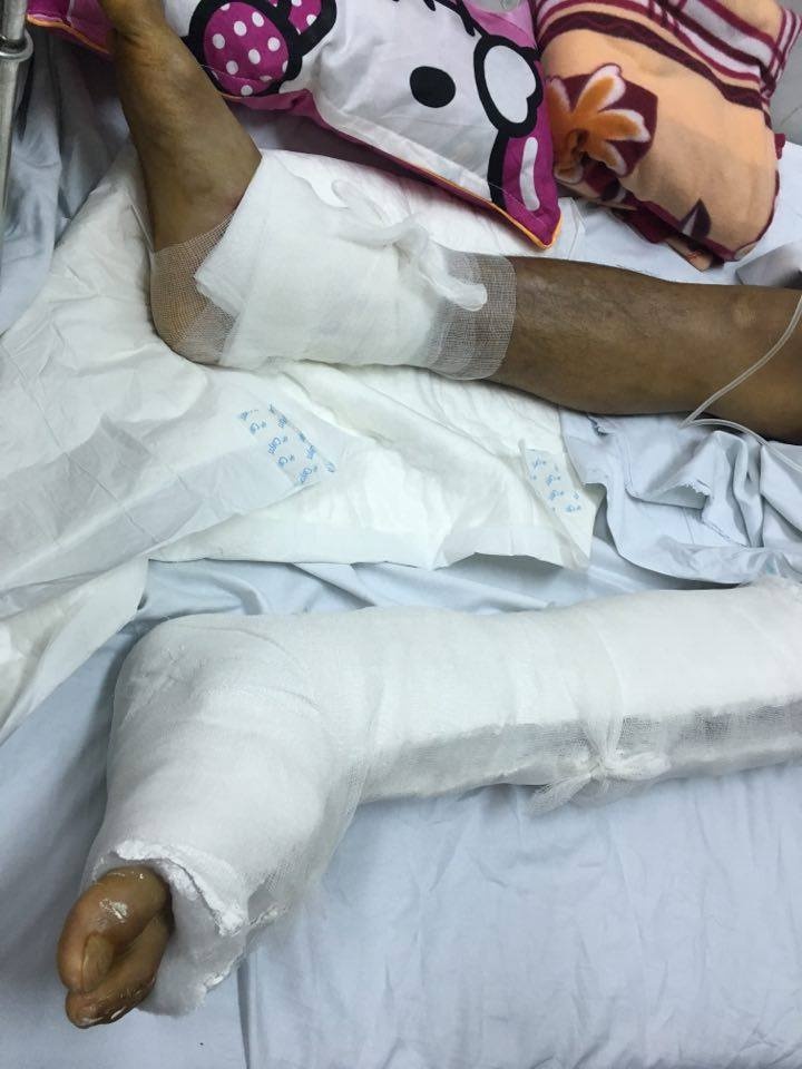 làm rõ nguyên nhân mổ nhầm chân ảnh 1 lam ro nguyen nhan mo nham chan anh 1