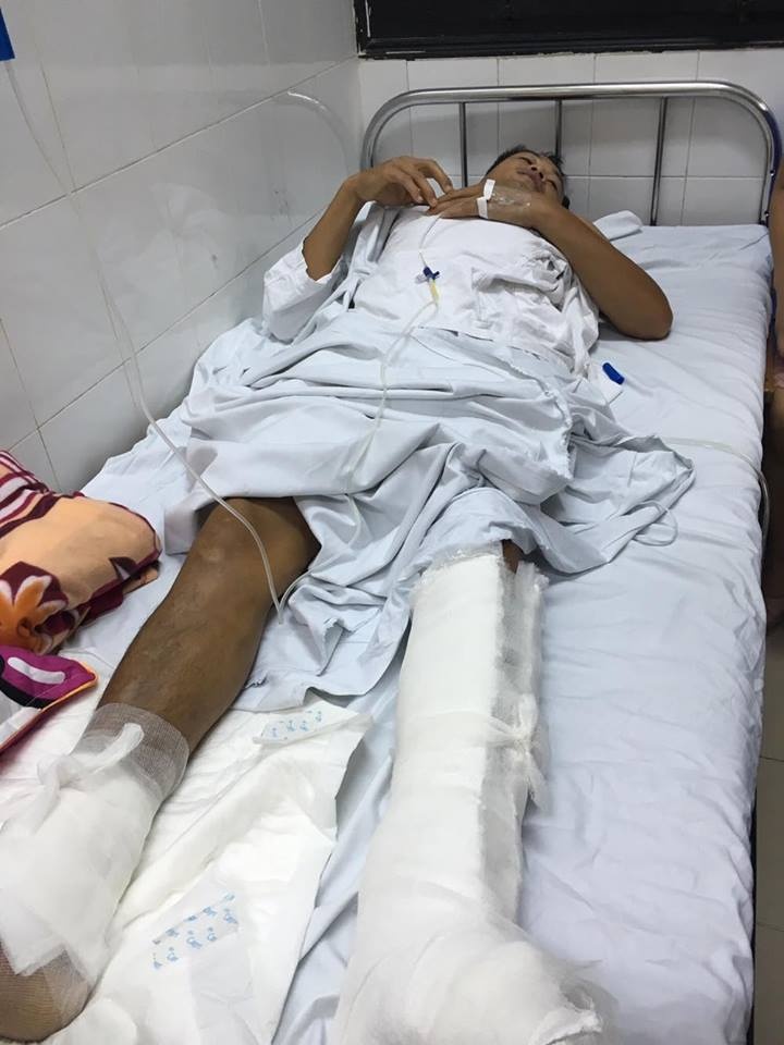 mổ nhầm chân bệnh nhân ảnh 1 mo nham chan benh nhan anh 1