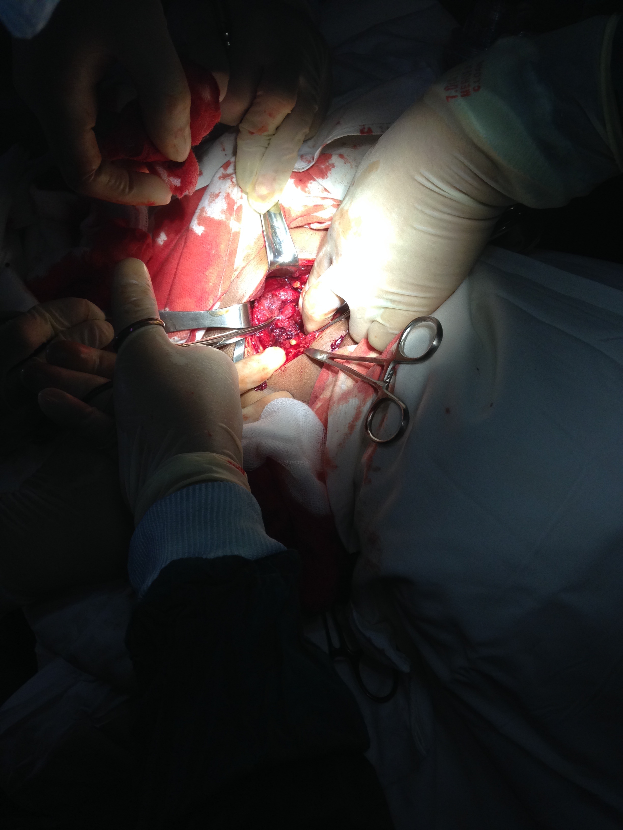 Ngan hang mau song cuu benh nhan o cua tu hinh anh