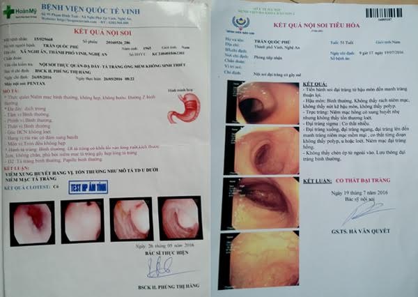 GS đầu ngành mở bụng nhưng không cắt khối u ảnh 3 GS dau nganh mo bung nhung khong cat khoi u anh 3