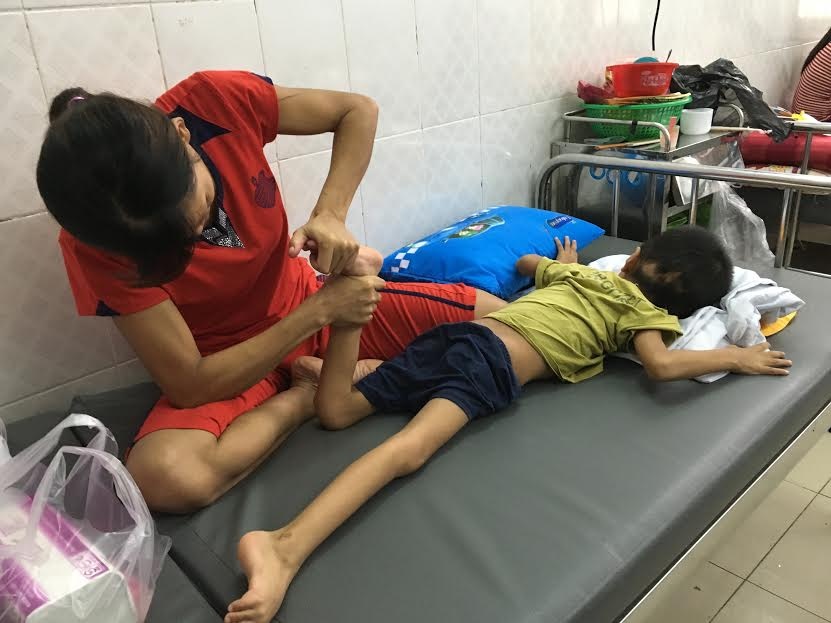 châm cứu điều trị trẻ bại não  ảnh 1 cham cuu dieu tri tre bai nao anh 1