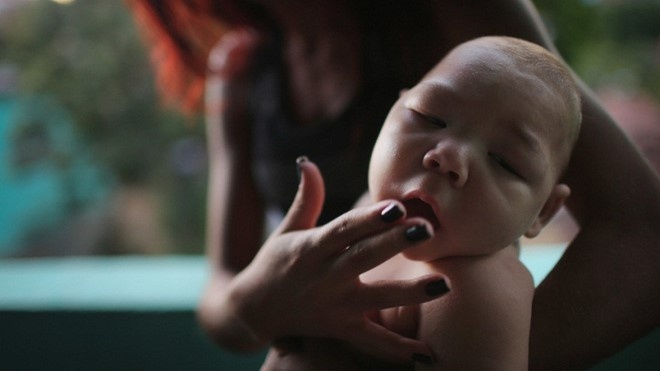 Them 2 phu nu nhiem virus Zika o Viet Nam hinh anh