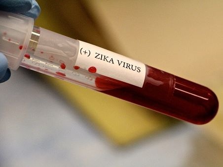 Lanh duoi 16 do C, virus Zika se bi tieu diet hinh anh