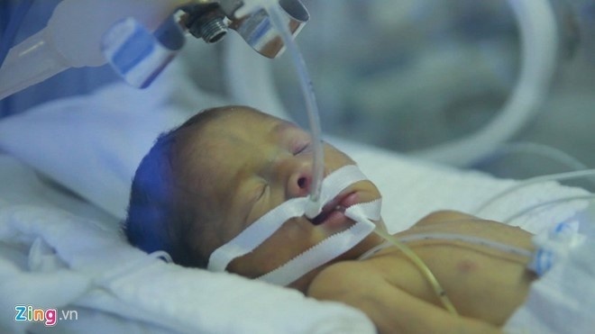 khoanh khac kho quen cua y te nam 2016 anh 5