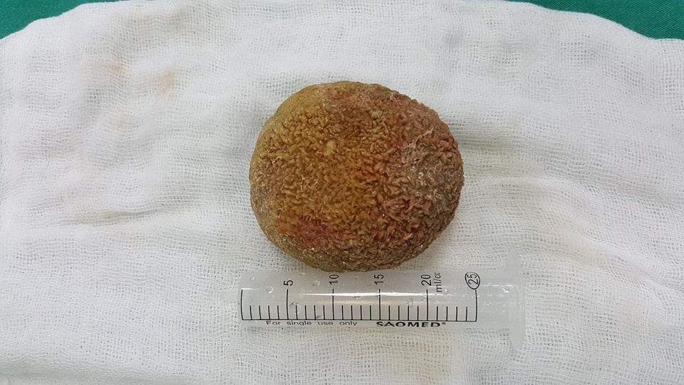 soi nang nua can trong bang quang anh 2