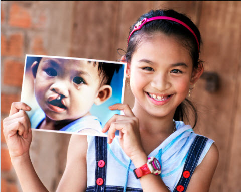 Khi nao tre sut moi, ho ham ech co the phau thuat? hinh anh