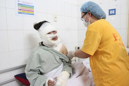 bóng bay bỗng nhiên phát nổ ảnh 1 bong bay bong nhien phat no anh 1