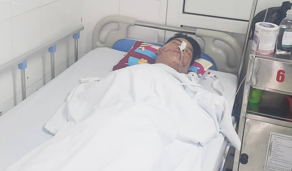 cho đầu vào miệng cá sấu ảnh 1 cho dau vao mieng ca sau anh 1