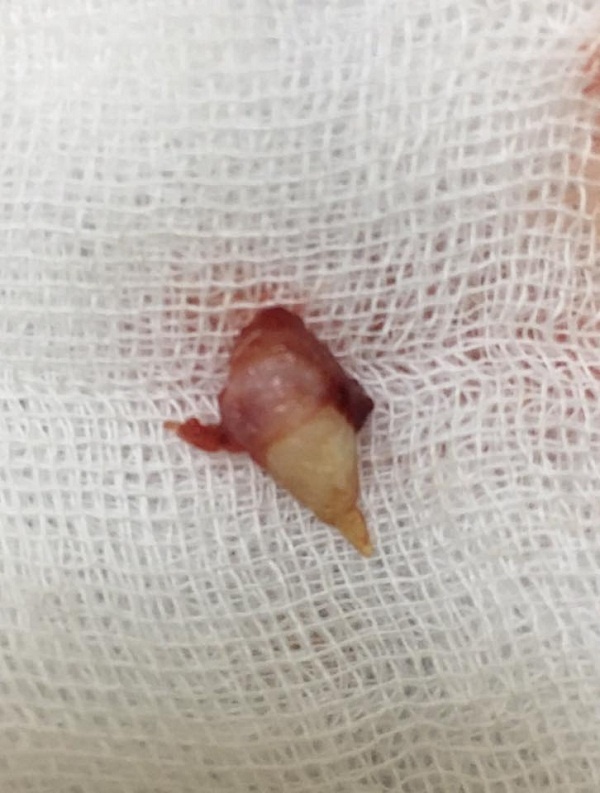 Rang moc trong mui cua be gai anh 1