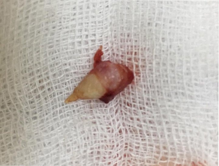 Rang moc trong mui cua be gai 4 tuoi hinh anh