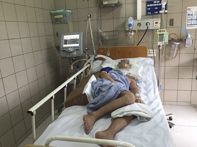 Canh bao mua ran doc: Hai benh nhan nguy kich do ran can hinh anh