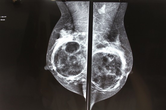 tinh huong nguy hiem khi nang nguc anh 1