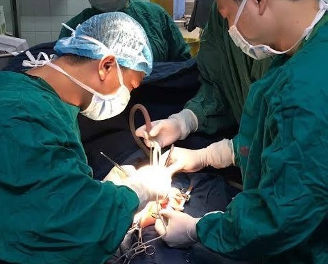 Khoi u hon 10 cm chen trong nguc be trai 10 thang tuoi hinh anh