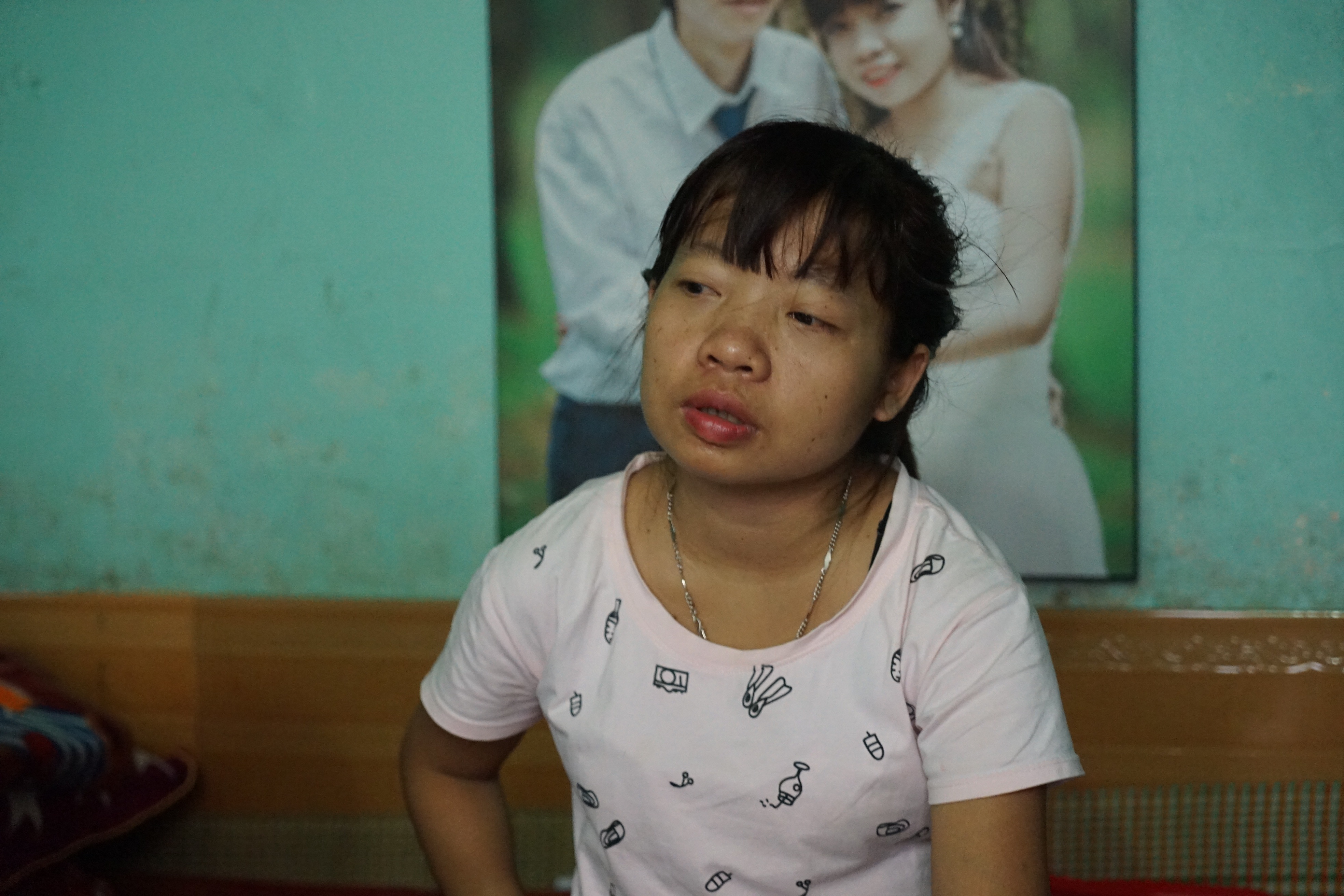 'An chung than' cua benh nhan suy than hinh anh