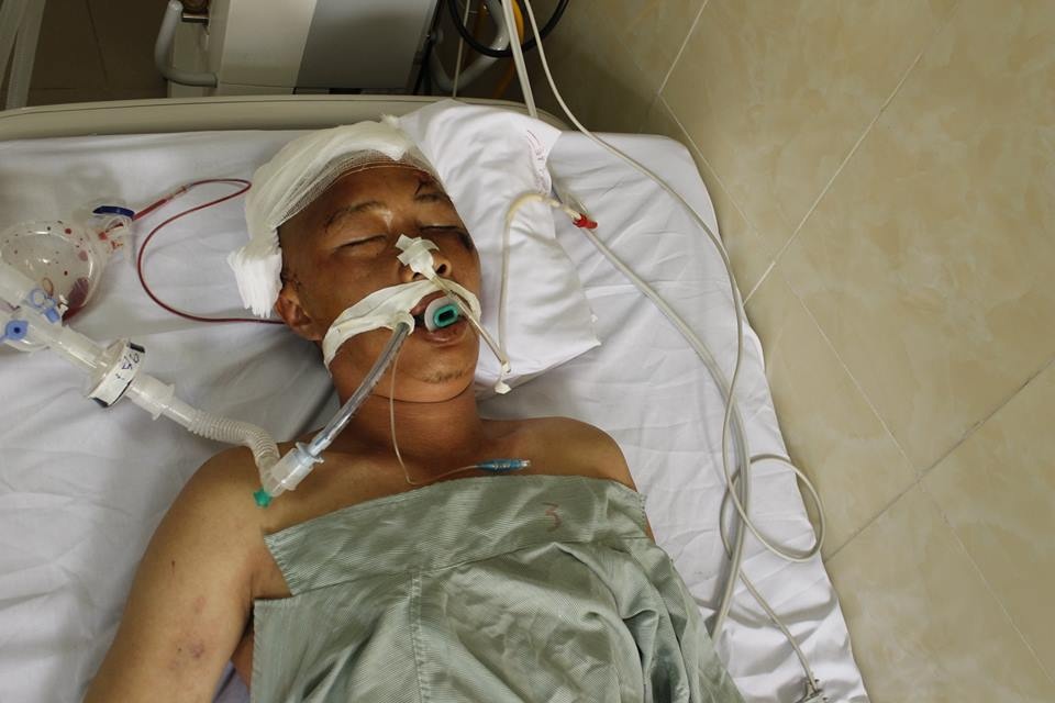 người đàn ông hôn mê nghi do tai nạn giao thông ảnh 1 nguoi dan ong hon me nghi do tai nan giao thong anh 1