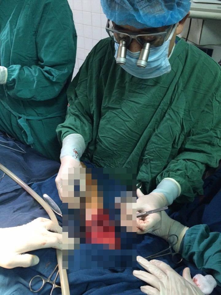 Canh tay be gai 5 tuoi bi dap nat anh 1