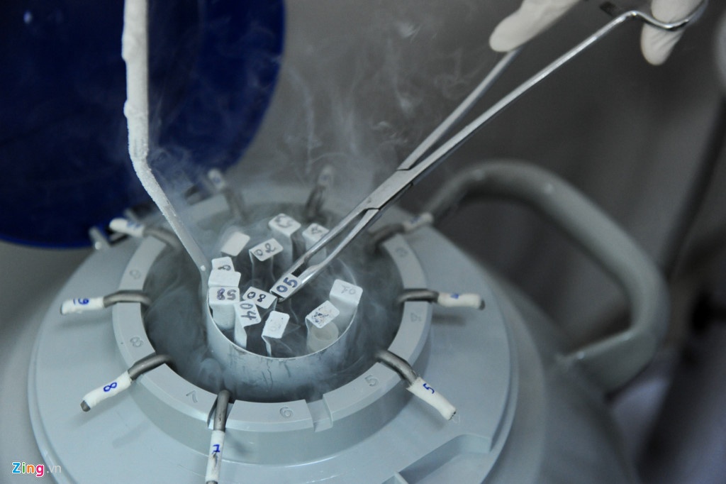 thiếu nguồn tinh trùng hiến tặng ảnh 1 thieu nguon tinh trung hien tang anh 1