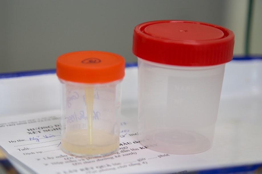 Gian nan chuyen 'tu xu' khi hien tinh trung hinh anh