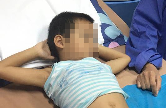 Gan 40 be trai nghi mac sui mao ga sau khi cat bao quy dau hinh anh