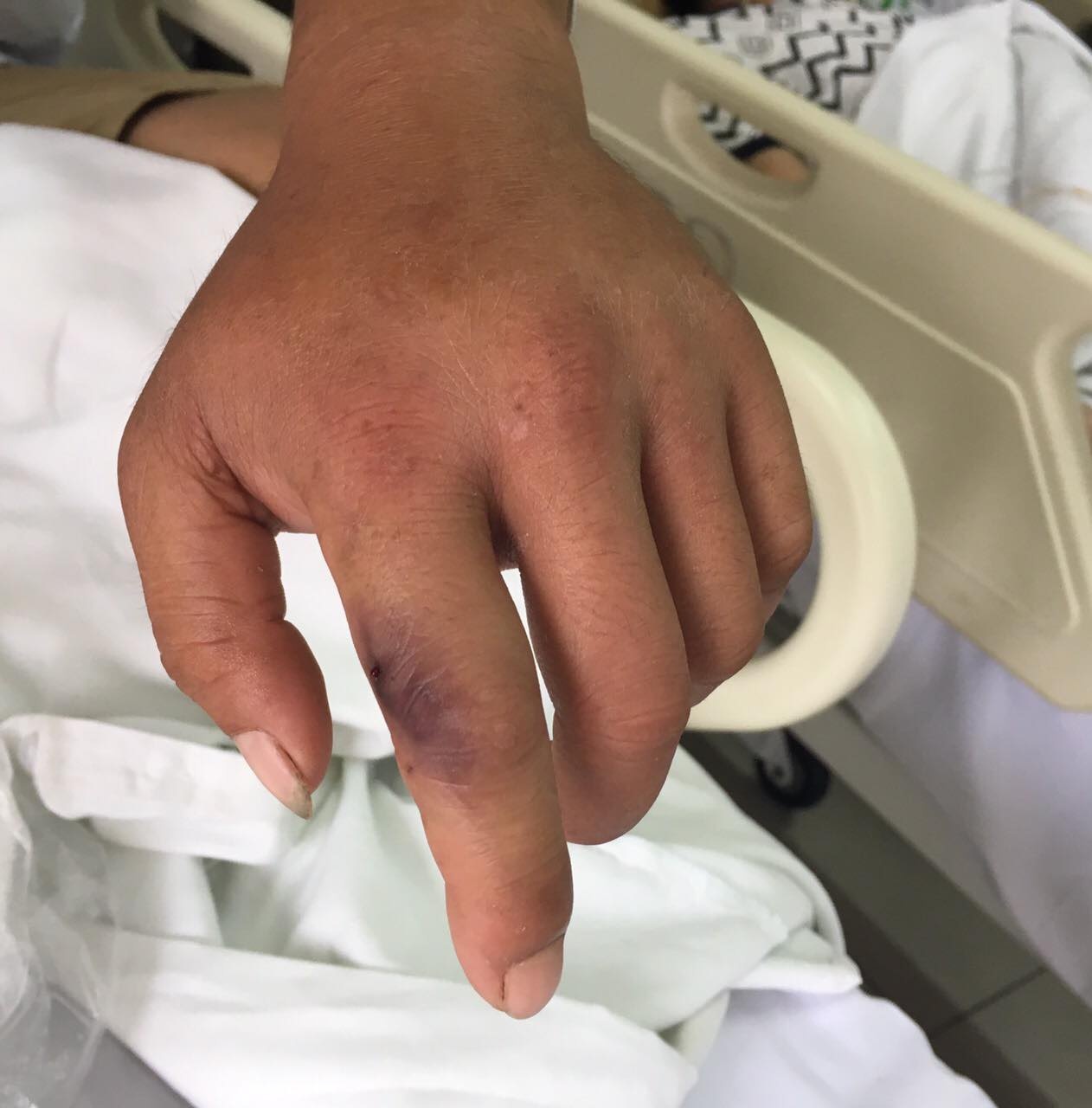 Sai lam khi bi ran can anh 1