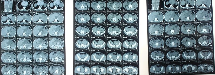 Nguoi dan ong mang hang tram khoi u anh 1