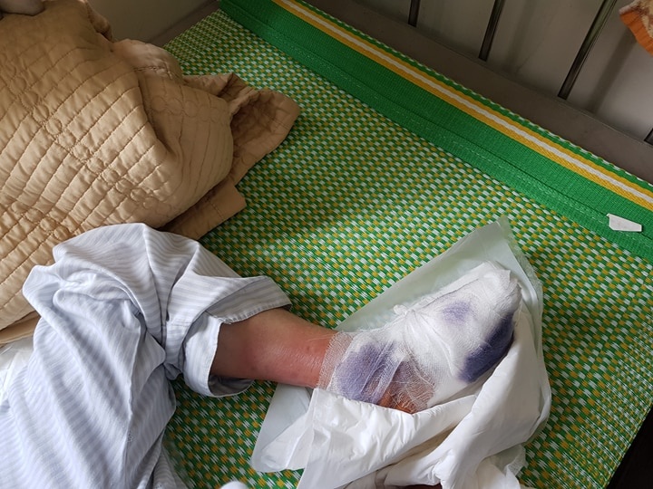 bien chung ban chan vi dai thao duong anh 2