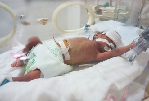 Tim thay vi khuan khang thuoc o ba benh nhi tung dieu tri tai Bac Ninh hinh anh