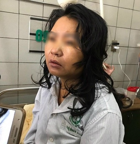 nguy kịch vì uống thuốc giảm cân ảnh 1 nguy kich vi uong thuoc giam can anh 1
