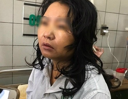 Thuc hu thong tin nu dieu duong nguy kich vi uong thuoc giam can hinh anh